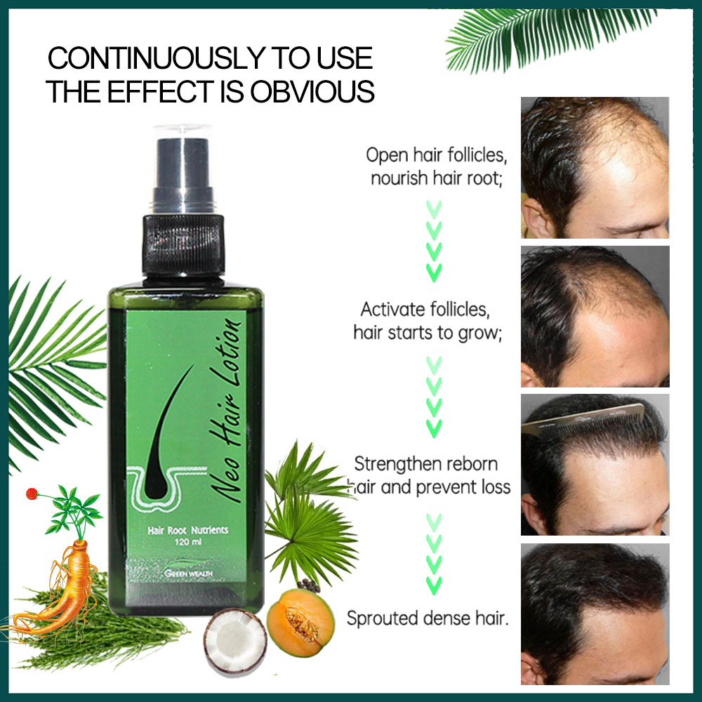 4 pcs Neo Hair Lotion 120ml Ha - Nutrition And Fitness ulasan dan harga